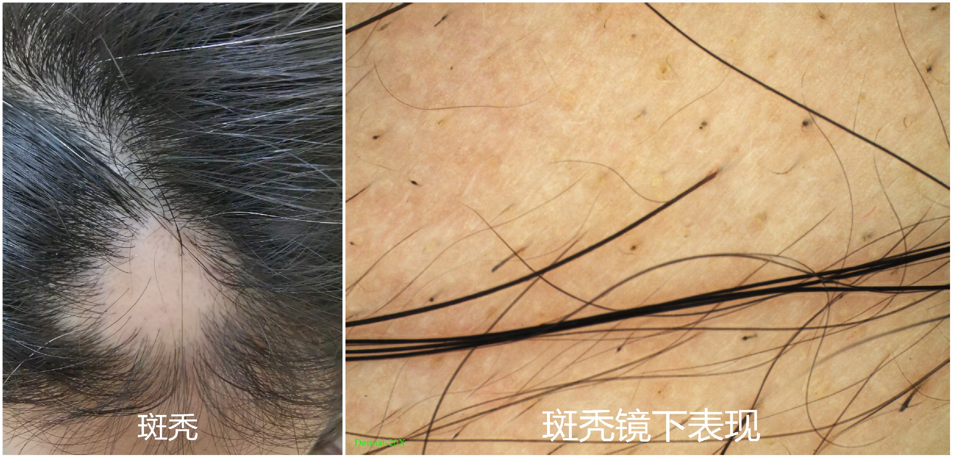 电子皮肤镜有什么用东平县第一人民医院皮肤科开展电子皮肤镜检查惠民活动_https://www.jmylbn.com_新闻资讯_第6张